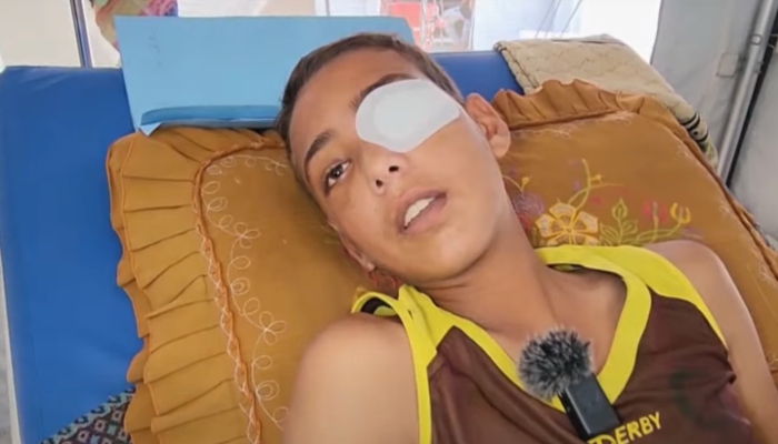 اسرائیلی فوج نے فلسطینی لڑکے کی آنکھ میں گولی مار دی